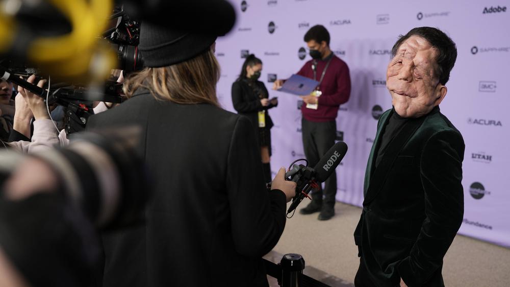 Seltene Gesichtsdeformation Schauspieler Adam Pearson stand bei der